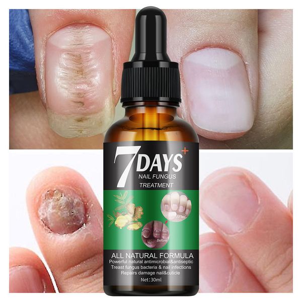 High Quality Repair and Nourishment Nail Brightening Essence Nail Repair Care Liquid Nail Nutrition Liquid